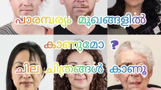 പാരമ്പര്യം മുഖങ്ങളിൽ കാണുമോ ?.  ഈ വീഡിയോ കണ്ടുനോക്കു.  || genetic portraits