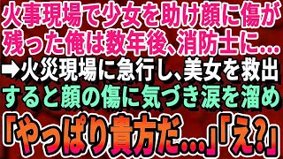 【感動する話】高校生の時に火事現場で少女を助けその時に出来た傷が残ったままの俺。消防士になったある日、一人の女性と出会い「その傷は…！」→翌日、女性の自宅に呼び出されると