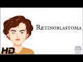 Retinoblastoma: Everything You Need To Know