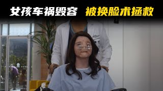 花季少女因车祸毁容，脸部移植后重生