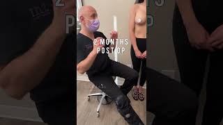 Silicone Breast Aug | Dr. Zarrabi #shorts