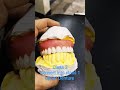 Class 3 Convert into Class 1 || Upper Complete Denture Set-up by Haider