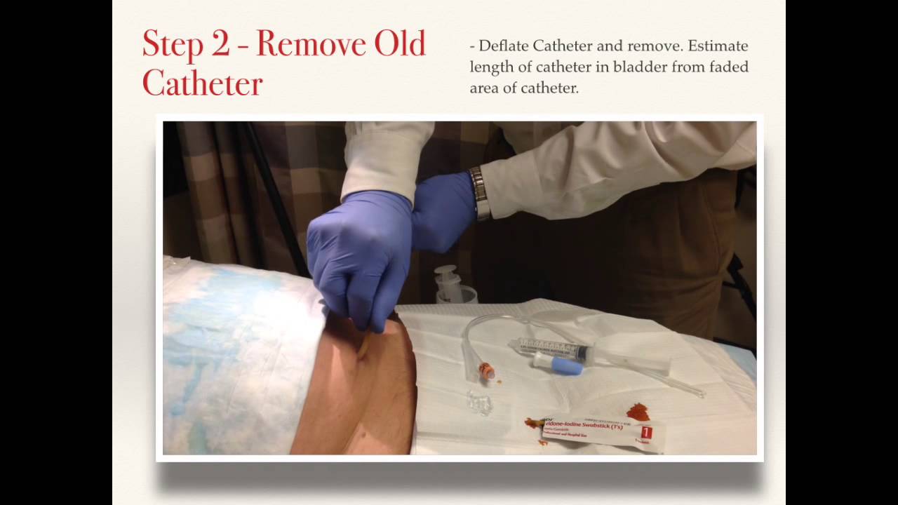 Catheter Stoma Care At Gregory Thompson Blog