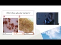 pharmac seminar series dermoscopy 4a of 5. chaos and clues selecting lesions to excise part 1