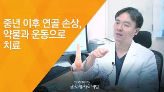 중년 이후 연골 손상, 약물과 운동으로 치료 - (2017.4.26_619회 방송)_100세 건강 무릎부터 튼튼하게