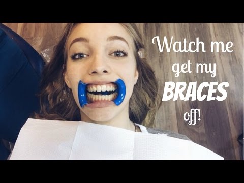 Watch me get my Braces off!!! Watch me get my Braces off!!!