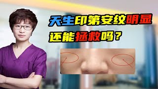 天生印第安纹明显 还能拯救吗？