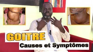 #1 - Goitre: Quelles sont les causes ? -  Pr Ousmane Ndiaye - SAMA XALAAT TV