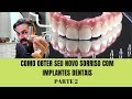 Seu Sorriso Completo com Implantes Dentários -  PARTE 2