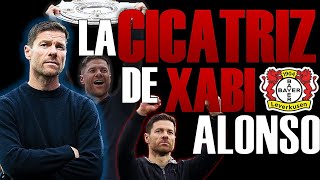 Xabi Alonso Y Su Cicatriz | HISTORIA | T1. Cap #15 Cicatriz, Sudor Y Un Café