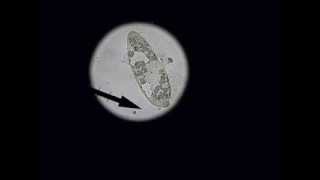 Paramecium Exploding!