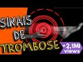 TROMBOSE: Sintomas de trombose, causas e tratamentos