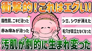 【有益スレ】衝撃的！これはエグい！汚肌が劇的に生まれ変った【ガルちゃんまとめ】