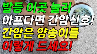 발등 이곳 눌러 아프면 간암 전조증상 신호네! 간 나쁘면 간암에 좋은 음식 양송이 이렇게 드세요!(발등통증 간에좋은음식 양송이효능 포함)