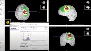 King's College London: Generating Synthetic Brains to Combat Neurological Diseases on Cambridge-1