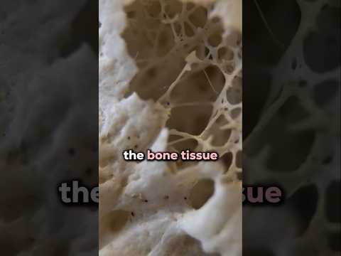 Is exercise bad for your bones?