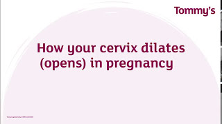 How Your Cervix Dilates During labour (in fruit) | Tommy's