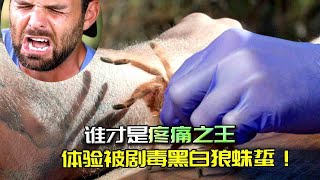 被黑白狼蛛咬一口有多疼？两位生物学家亲自尝试，像是被蜜蜂蜇！