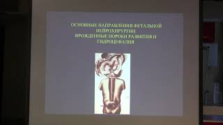 Врач-нейрохирург, выступление в г. Киев 19.10.2019 на встрече докторов и родителей