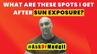 WHAT ARE THESE SPOTS I GET AFTER SUN EXPOSURE?