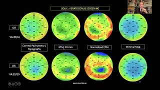 The Broad Spectrum of Full Range OCT Anterior Segment with Solix . ICOOR ROME 2021