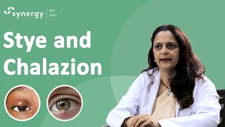 What is a Stye? What is a Chalazion? Whats are the causes and how can we prevent it?