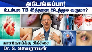 உடம்புல TB இத்தனை இடத்தில் வருமா? | Dr. Jayaraman | Poongaatru