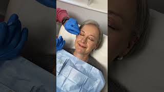 #short Jacqui's Blepharoplasty stitches removal | The Harley Medical Group