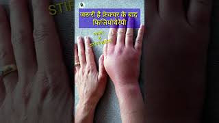 जरूरी है फ्रेक्चर के बाद फिजियोथैरेपी | #shorts #fracture #exercises #physiotherapy