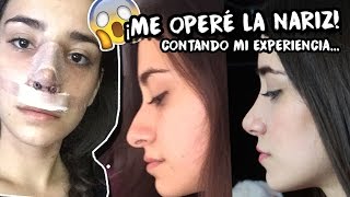 ME OPERÉ LA NARIZ | Mi experiencia día con día.