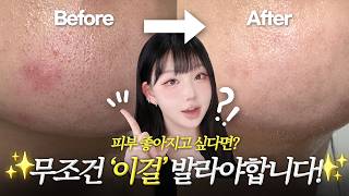 🔥피부 좋아지고 싶다면? 무조건 ‘이걸’ 발라야합니다‼️수분/보습/진정/장벽 케어템 특집.zip📁올영N통째 인생템들만 보여준다ㅣ톡신TOXIN