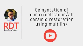 Cementation of IPS. e.max cad/press/ all-ceramic restorations using multilink automix