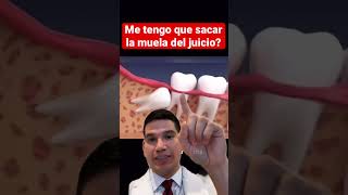 🦷MUELAS DEL JUICIO se necesitan sacar? 🤔 Muelas del juicio