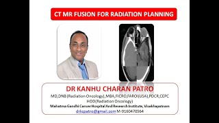 PRACTICAL DEMONSTRATION OF CT_MR FUSION IN RADIATION PLANNING