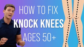 How to Fix "Knock Knees" (Ages 50+)