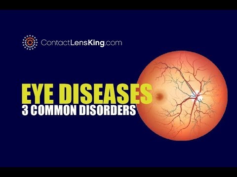 Eye Diseases | 3 Common Eye Conditions - YouTube