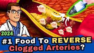 #1 Food to Clean out Your Arteries? [Blood Clots \u0026 Arteriosclerosis]