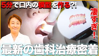 最先端の歯科医院！セラミックはどのように作られる？口腔内のシミュレーションに密着