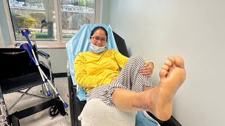 Ankle fracture and recovery timeline