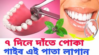 date poka lagle ki korbo | date poka valo korar upay | teeth poka