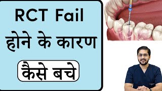 RCT fail होने के कारण | Best root canal treatment in Indore | Seraphic Dental in Indore