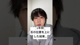 1年間舌の位置を上にした結果… #口呼吸