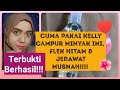 FLEK HITAM & JERAWAT HILANG???Hanya Pakai Krim Kelly+Minyak Zaitun???//Bilik Cantik88