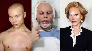 10 Unusual People Who Took Plastic Surgery Too Far