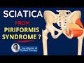 Piriformis Syndrome, Sciatica Symptoms & Back Pain