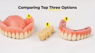 Comparing The Top 3 Options for Replacing Teeth