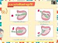 28 12 2564 ป.3 วิชาสุขศึกษา เรื่องสรุปทบทวนทันตสุขภาพฟัน