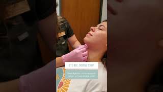 Kybella Double Chin Disolver | Viva Day Spa + Med Spa