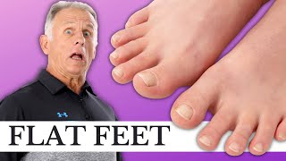 3 Critical Exercises for Pronated, Flat Feet (Causing Foot & Leg Pain?)