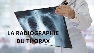 Critères d'interprétation d'une radiographie thoracique  #radiologie